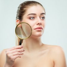Know the Reasons Behind Getting Dark Spots on the Face