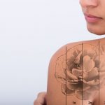 One of LA's Best Tattoo Removal Specialists