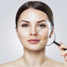 All You Need to Know About Kybella® Treatment