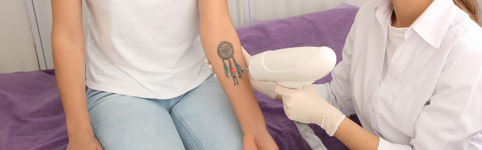 Remove Arm Tattoos