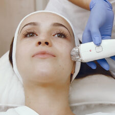 What’s the Best Skincare Routine to Follow After Acne Surgery?