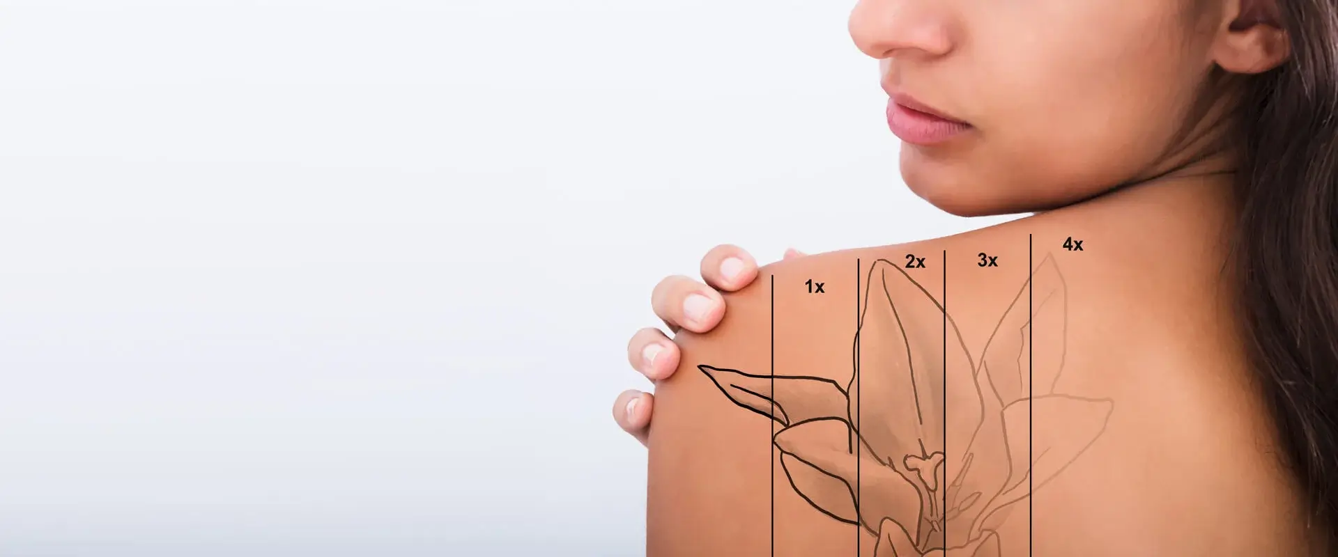 Tattoo removal treatment with advanced technology at medispa in Glendale