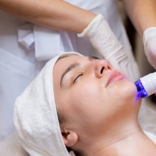 Top 5 Benefits of PicoSure Laser Acne Scar Treatment