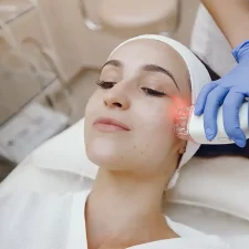 PicoSure Laser Treatment for Acne Scars: A Step-by-Step Guide