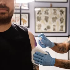Why Some Tattoos Require More Removal Sessions Than Others